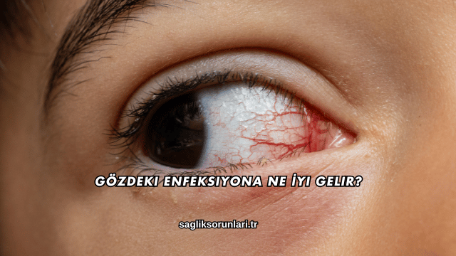 Gözdeki Enfeksiyona Ne İyi Gelir?