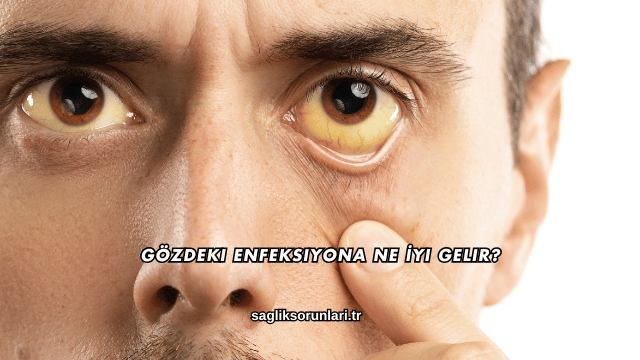 Gözdeki Enfeksiyona Ne İyi Gelir?