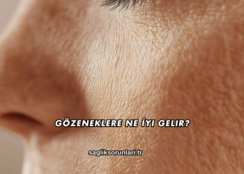 Gözeneklere Ne İyi Gelir?