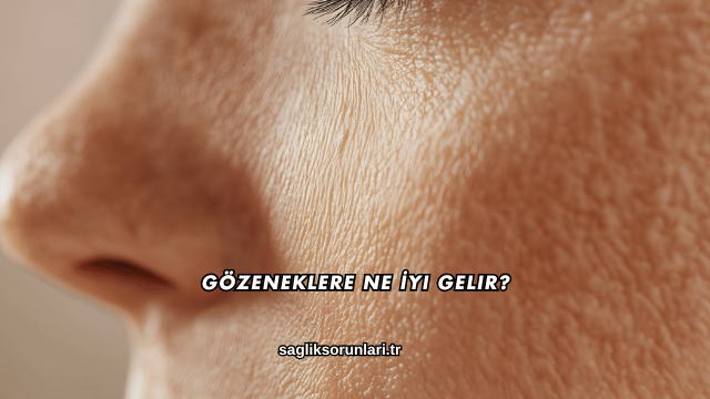 Gözeneklere Ne İyi Gelir?