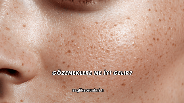 Gözeneklere Ne İyi Gelir?