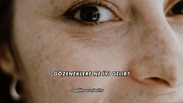 Gözeneklere Ne İyi Gelir?