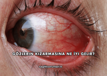 Gözlerin Kızarmasına Ne İyi Gelir?