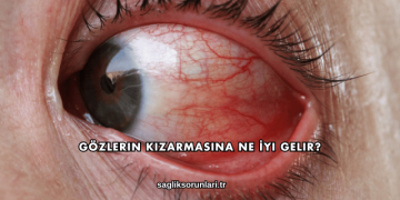 Gözlerin Kızarmasına Ne İyi Gelir?