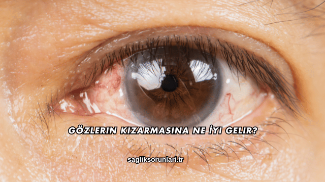 Gözlerin Kızarmasına Ne İyi Gelir?