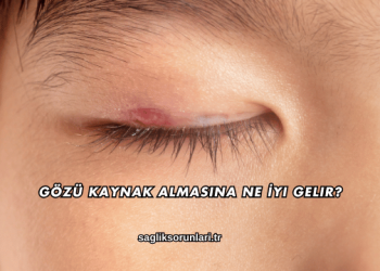 Gözü Kaynak Almasına Ne İyi Gelir?