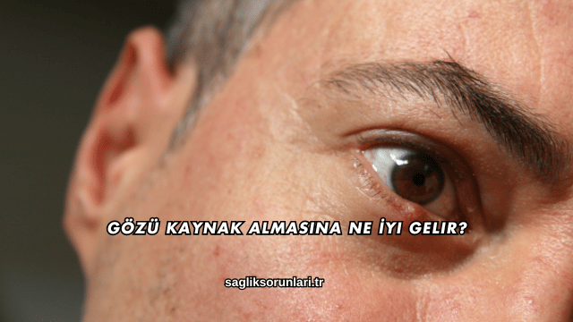 Gözü Kaynak Almasına Ne İyi Gelir?