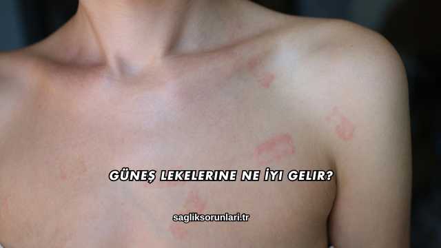 Güneş Lekelerine Ne İyi Gelir?