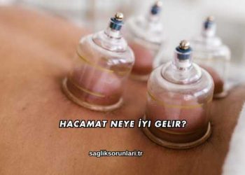 Hacamat Neye İyi Gelir?