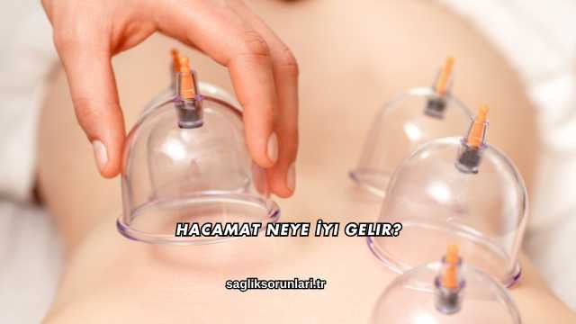 Hacamat Neye İyi Gelir?
