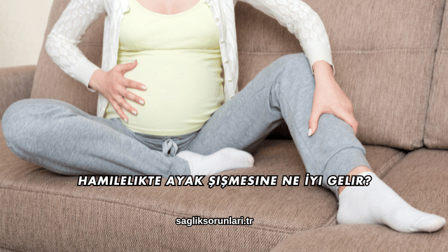 Hamilelikte Ayak Şişmesine Ne İyi Gelir?