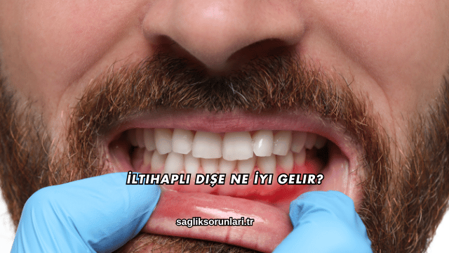 İltihaplı Dişe Ne İyi Gelir?