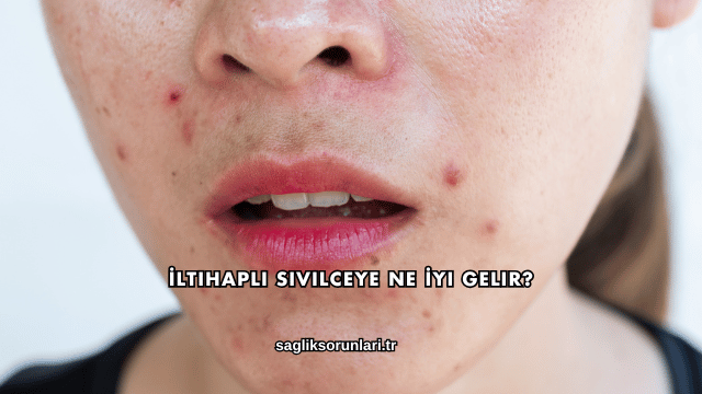 İltihaplı Sivilceye Ne İyi Gelir?