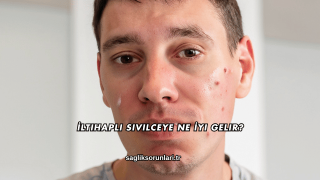 İltihaplı Sivilceye Ne İyi Gelir?