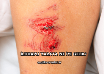 İltihaplı Yaraya Ne İyi Gelir?