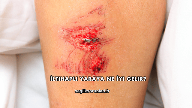 İltihaplı Yaraya Ne İyi Gelir?
