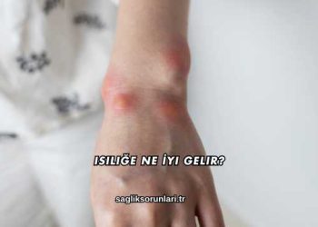 Isiliğe Ne İyi Gelir?