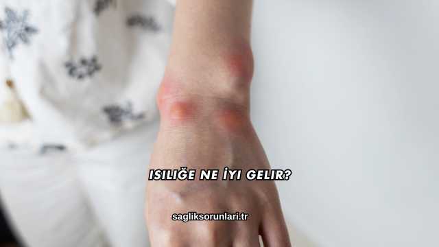 Isiliğe Ne İyi Gelir?