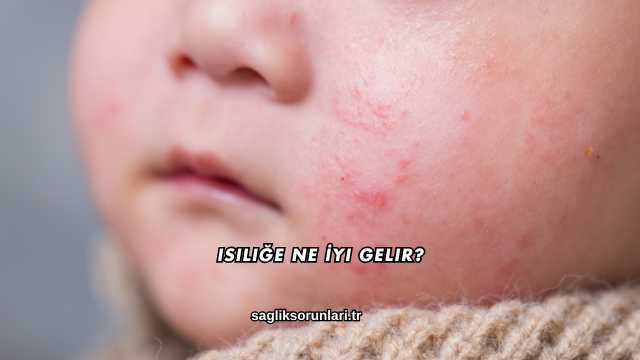 Isiliğe Ne İyi Gelir?