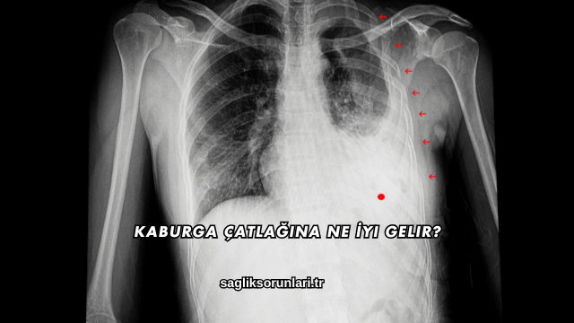 Kaburga Çatlağına Ne İyi Gelir?