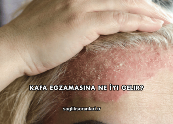 Kafa Egzamasına Ne İyi Gelir?