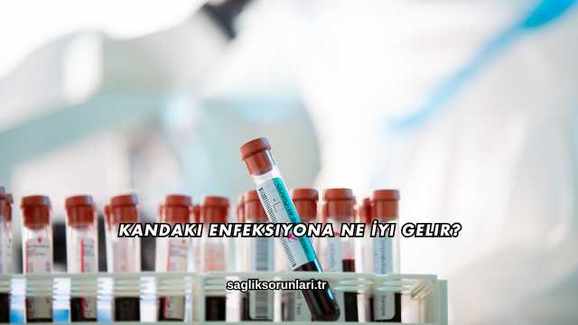 Kandaki Enfeksiyona Ne İyi Gelir?