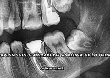 Kaplamanın Altındaki Diş Ağrısına Ne İyi Gelir?