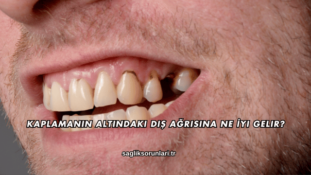 Kaplamanın Altındaki Diş Ağrısına Ne İyi Gelir?