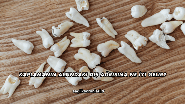 Kaplamanın Altındaki Diş Ağrısına Ne İyi Gelir?