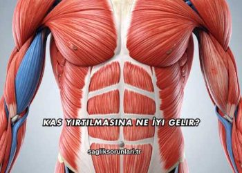 Kas Yırtılmasına Ne İyi Gelir?