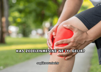 Kas Zedelenmesine Ne İyi Gelir?