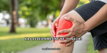 Kas Zedelenmesine Ne İyi Gelir?