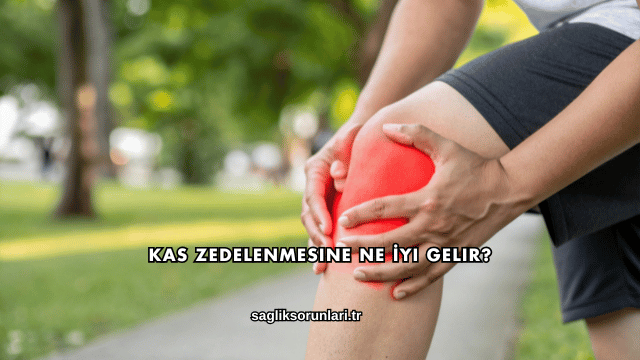 Kas Zedelenmesine Ne İyi Gelir?