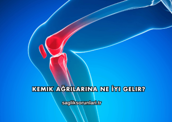 Kemik Ağrılarına Ne İyi Gelir?