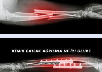 Kemik Çatlak Ağrısına Ne İyi Gelir?