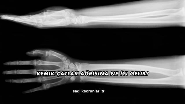 Kemik Çatlak Ağrısına Ne İyi Gelir?