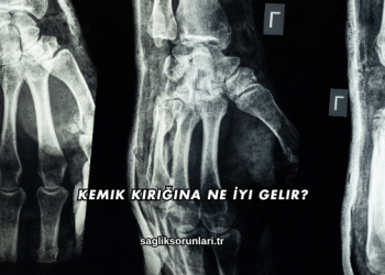 Kemik Kırığına Ne İyi Gelir?