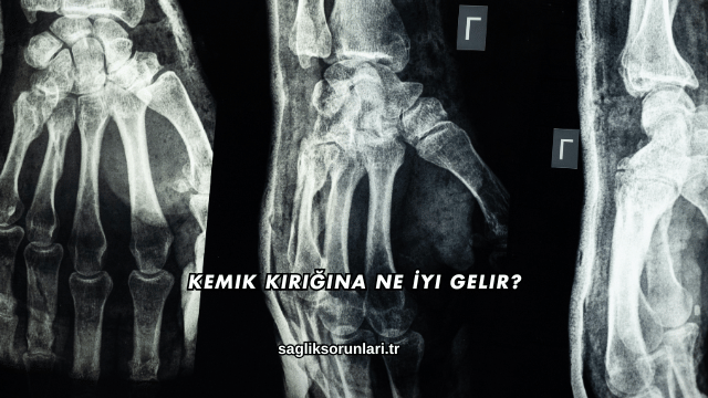 Kemik Kırığına Ne İyi Gelir?