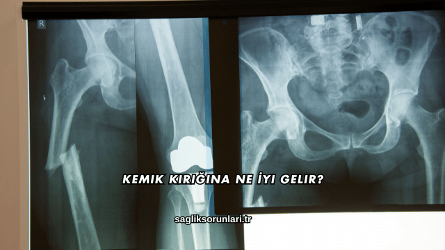Kemik Kırığına Ne İyi Gelir?