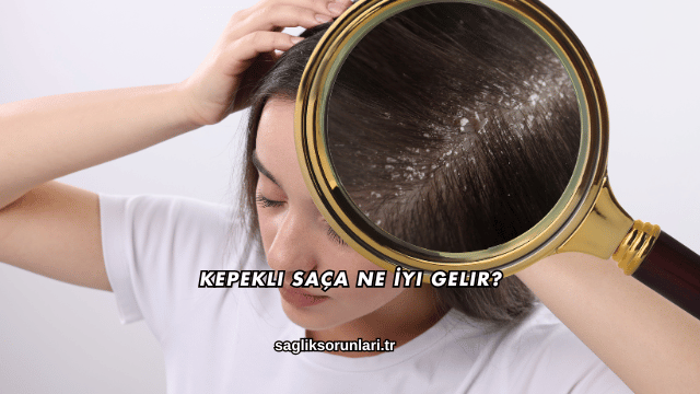 Kepekli Saça Ne İyi Gelir?