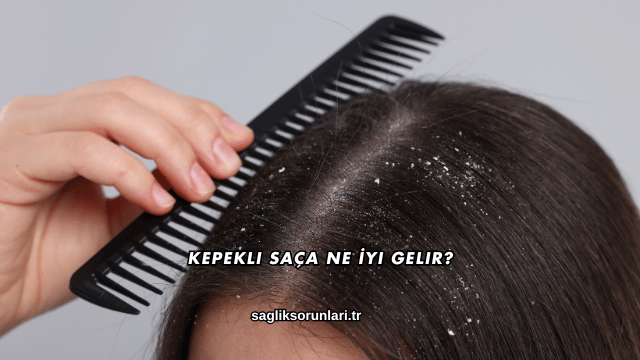 Kepekli Saça Ne İyi Gelir?