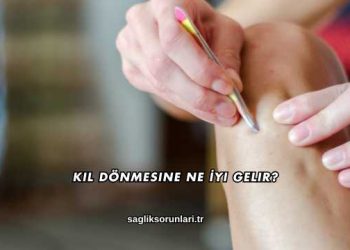 Kıl Dönmesine Ne İyi Gelir?