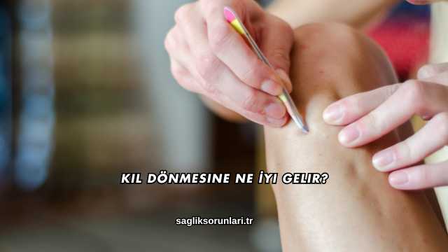 Kıl Dönmesine Ne İyi Gelir?