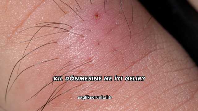 Kıl Dönmesine Ne İyi Gelir?