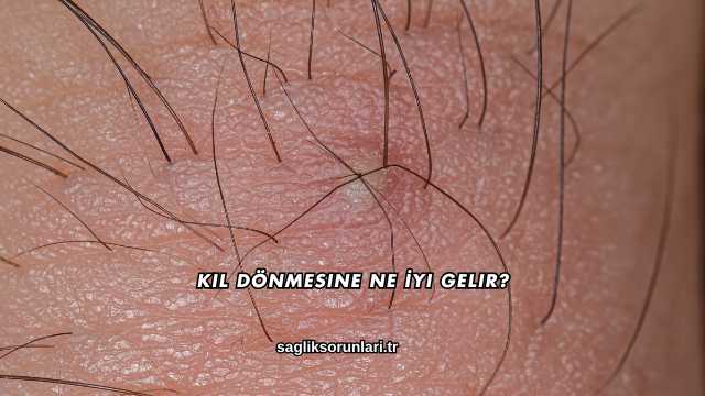 Kıl Dönmesine Ne İyi Gelir?