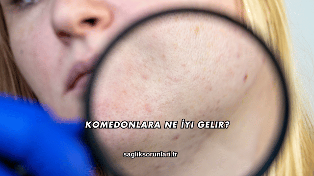 Komedonlara Ne İyi Gelir?