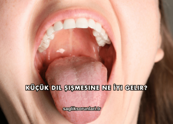 Küçük Dil Şişmesine Ne İyi Gelir?