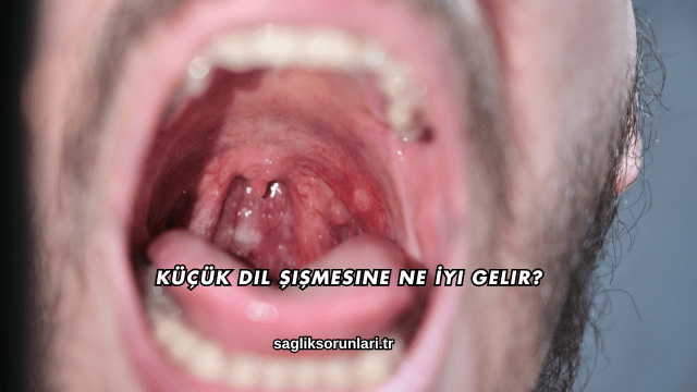 Küçük Dil Şişmesine Ne İyi Gelir?