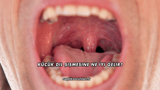 Küçük Dil Şişmesine Ne İyi Gelir?