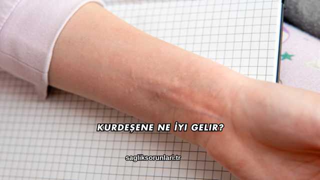 Kurdeşene Ne İyi Gelir?